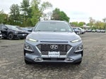 2021 Hyundai Kona Ultimate